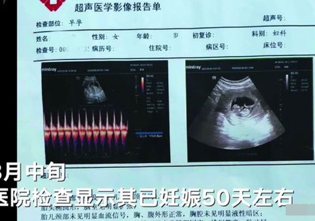 邯鄲通報(bào)女精神病患者致孕案1.jpg