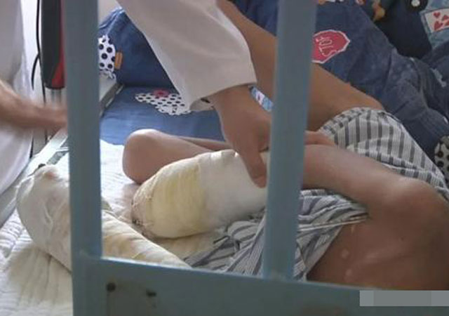 律師解讀男孩被父親燒傷1.jpg