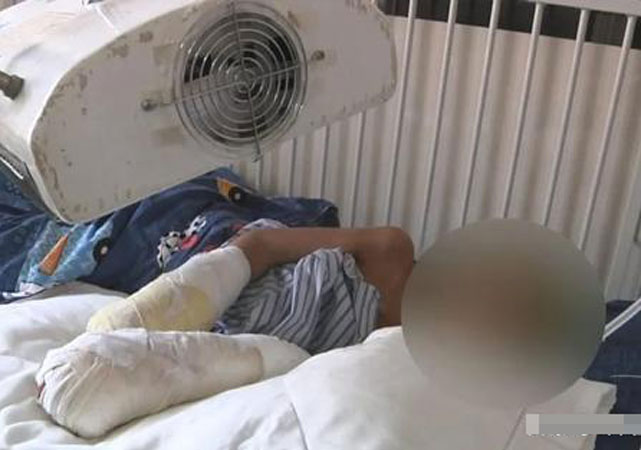 律師解讀男孩被父親燒傷2.jpg