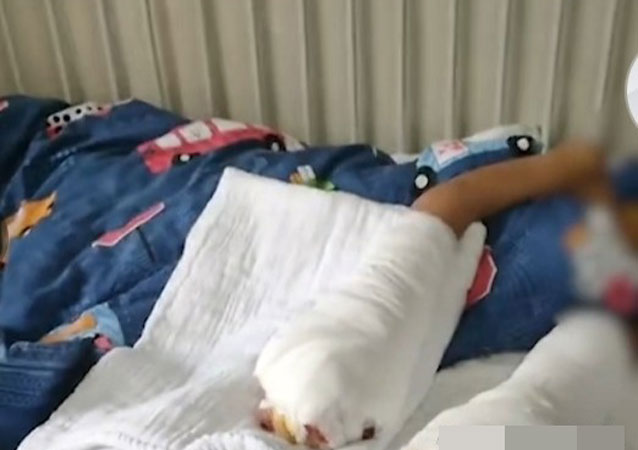 律師解讀男孩被父親燒傷3.jpg