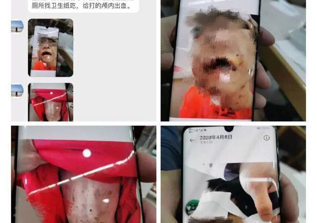 警方通報(bào)黑龍江女童被虐打1.jpg