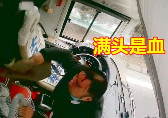 司機被乘客用安全錘砸頭4.jpg