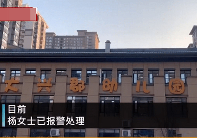 幼兒園3歲女童身上現(xiàn)29處針眼4.jpg