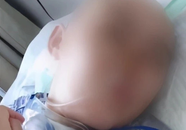 山西12歲女孩被繼母打成植物人1.jpg